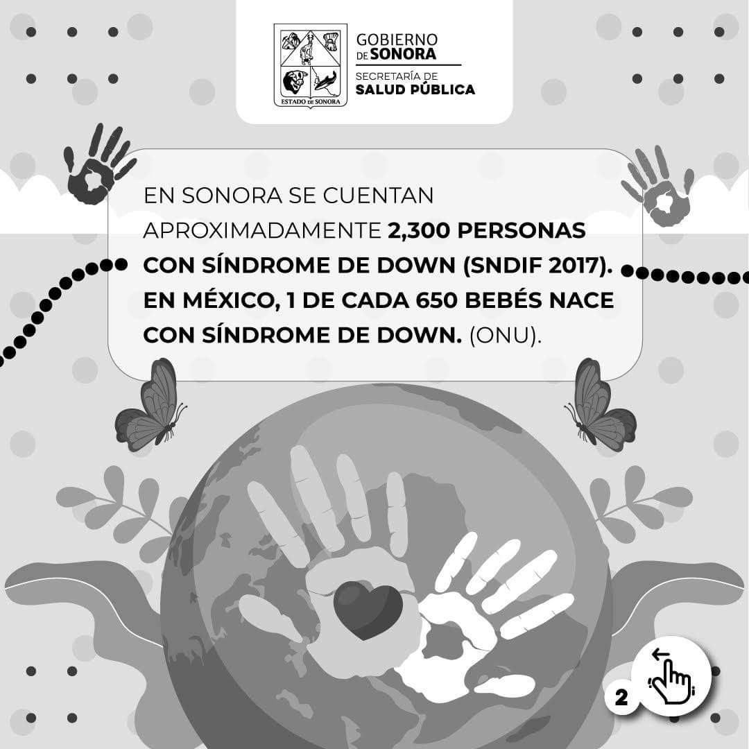 Disponibles clínicas para la atención del Síndrome de Down: Salud Sonora