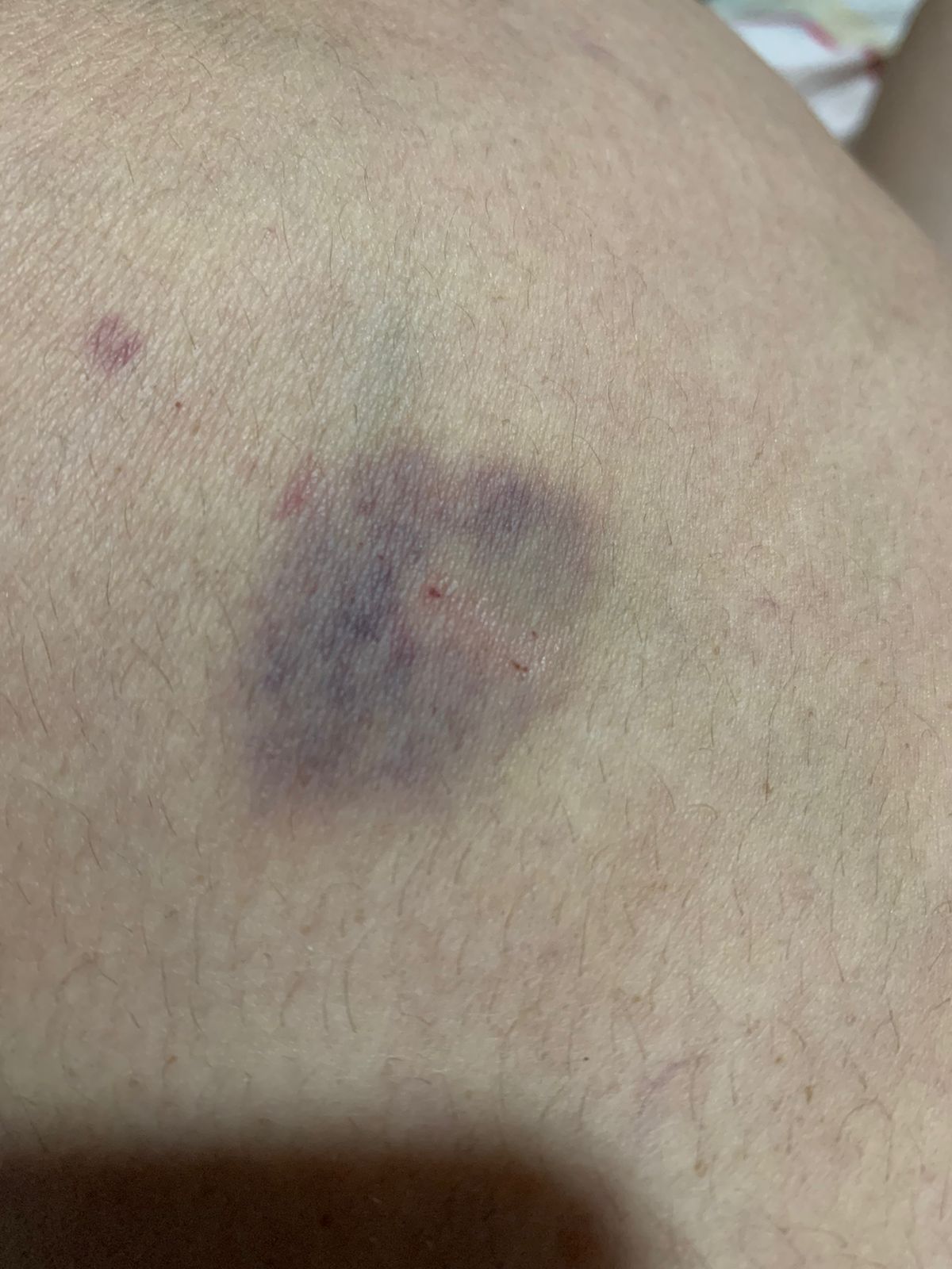 Víctima de violencia familiar obligada a pagarle a agresor