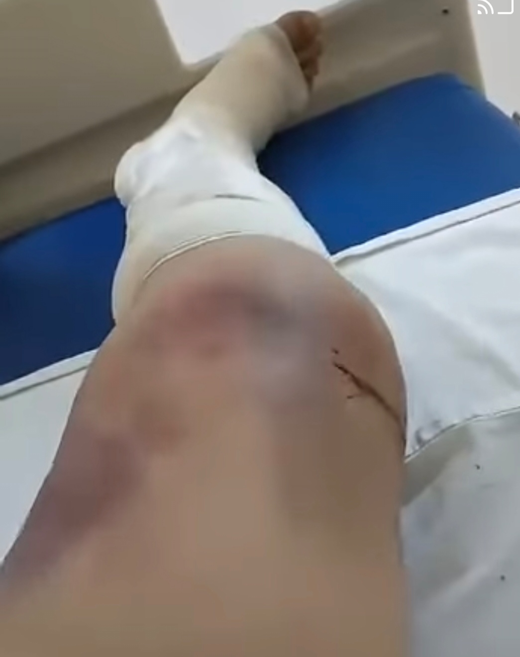 Víctima de lesiones denuncia influyentísimo