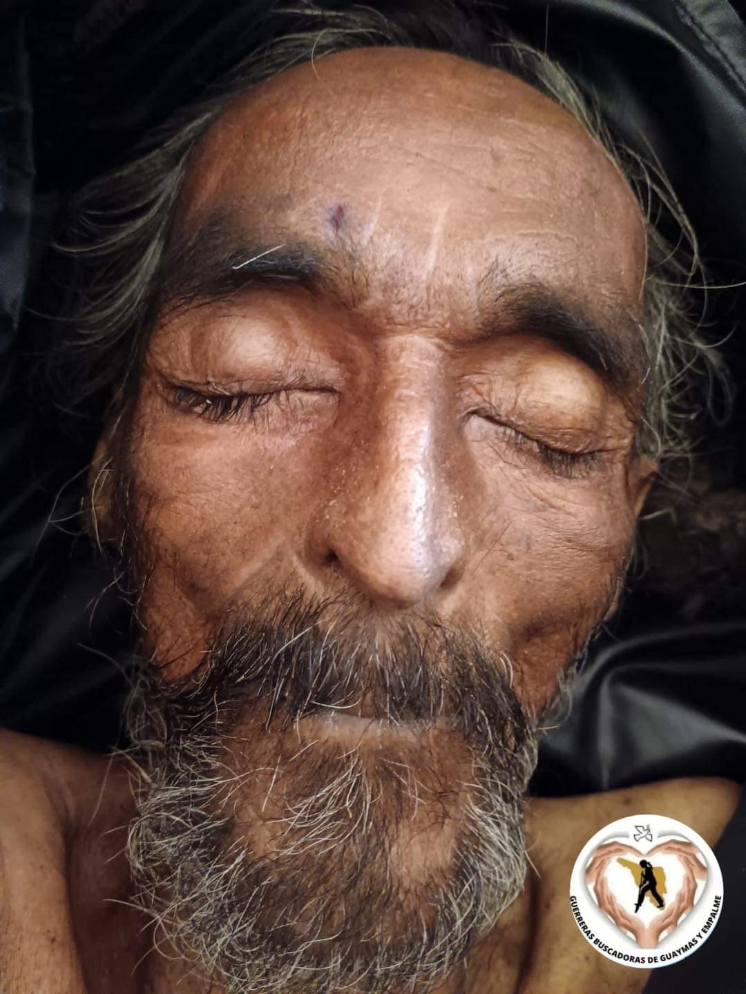 Indigente muere en IMSS Bienestar