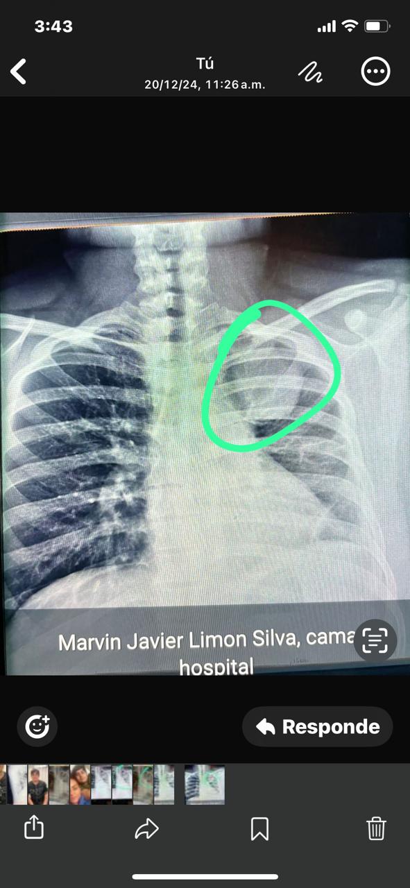 Joven con enfermedad pulmonar espera traslado