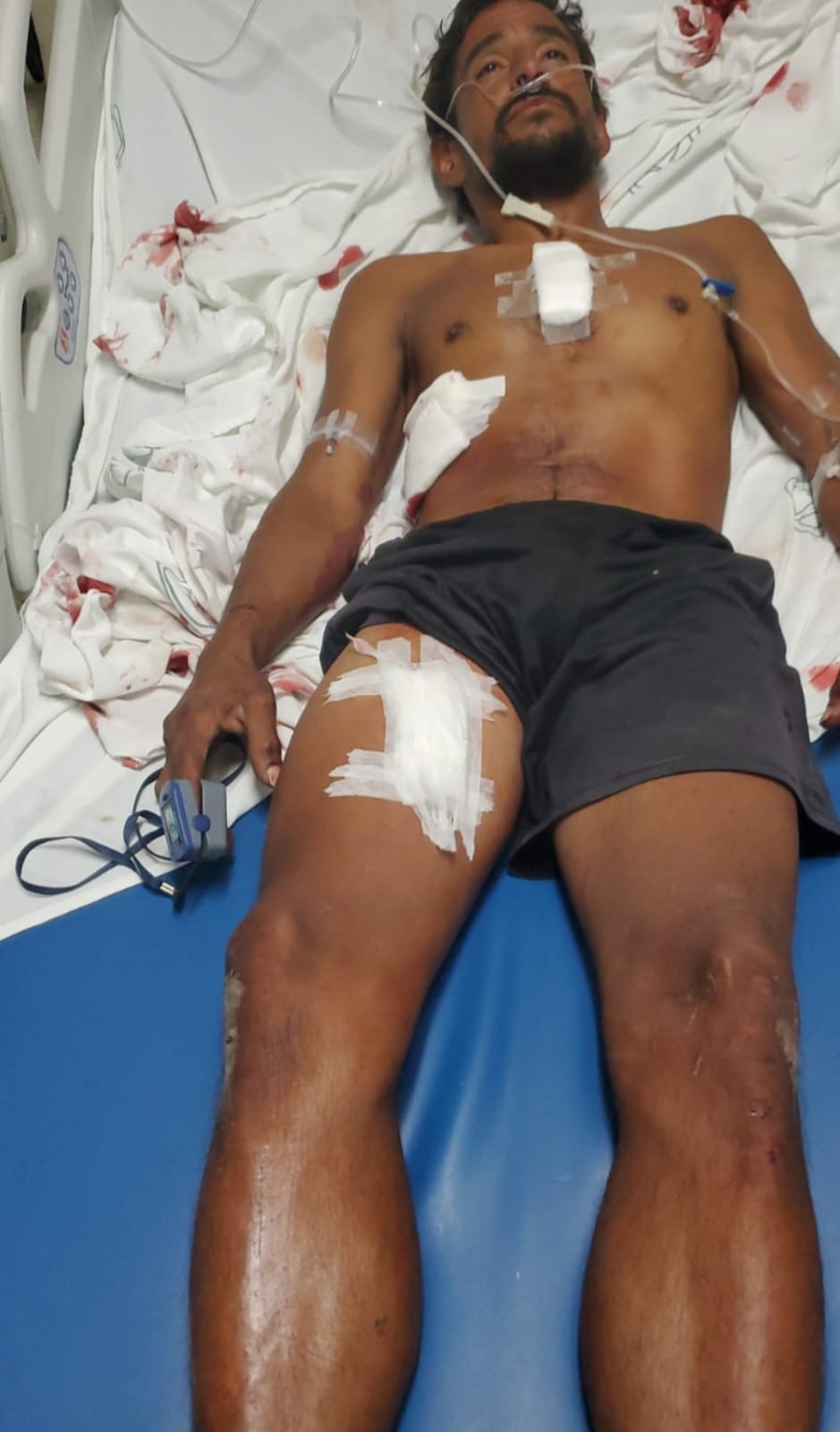 Balean a sujeto en San Carlos