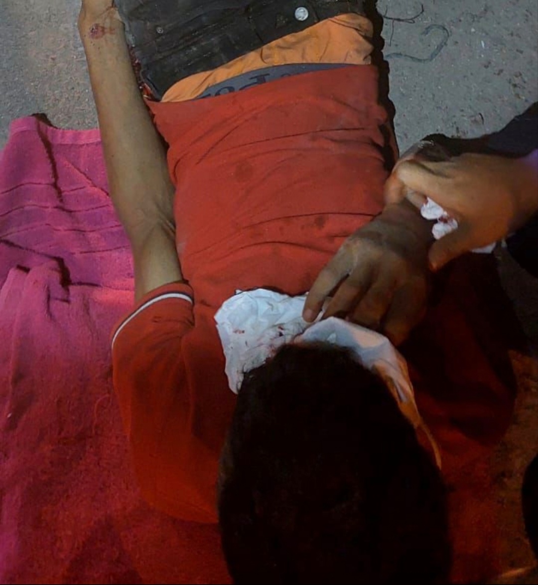 Motociclista adolescente puede perder ojo