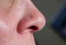 Golpean a hombre