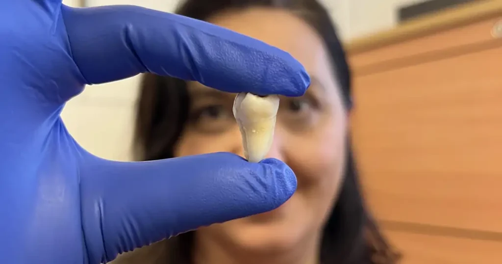 ana angelova volponi con un diente b80f160b 250415115252 1200x630 1