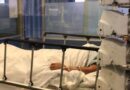 Fallece adulto mayor tras sufrir quemaduras