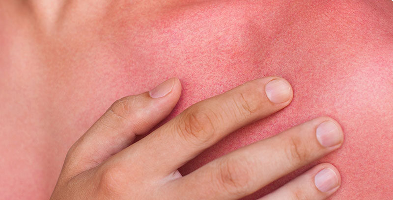 consecuencias radiaciones solares 3