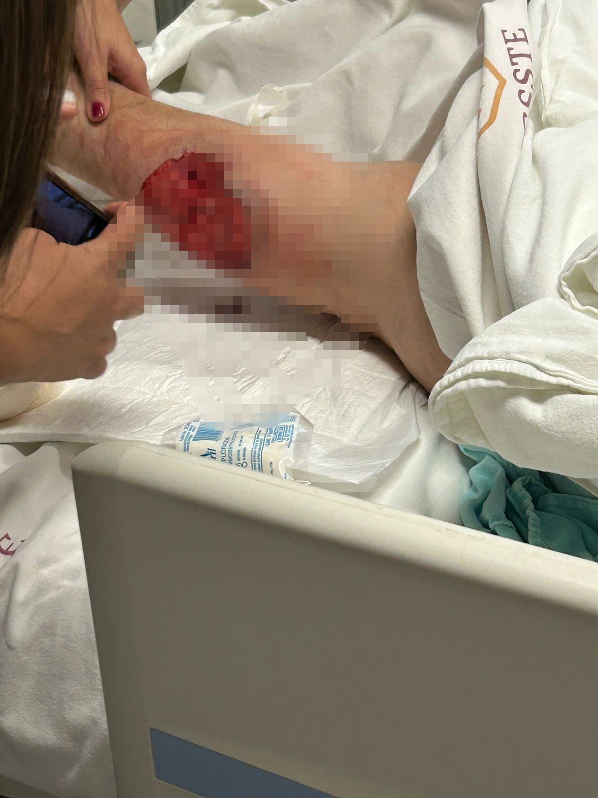 Se niegan a responder por agresión animal