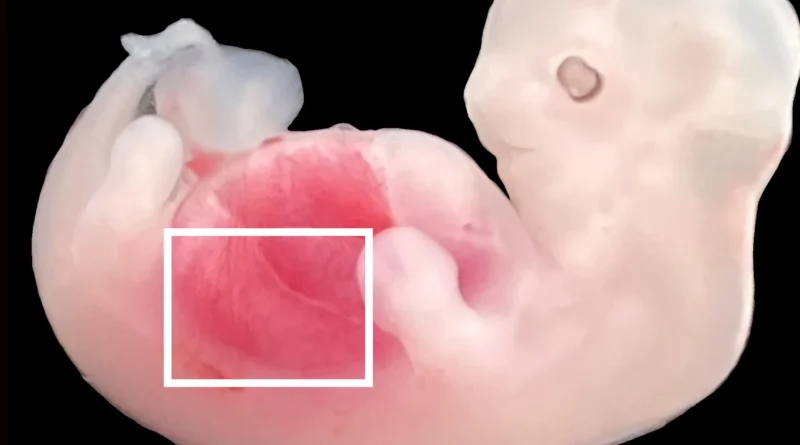 embryo science This figure shows humanized kidney cells red fluorescence inside the embryo compared to a wildtype pig embryo. CREDIT Wang Xie Li Li and Zhang et al Cell Stem Cell.png
