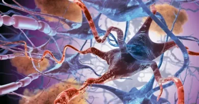 131010104743 alzheimer 464x261 spl.jpg