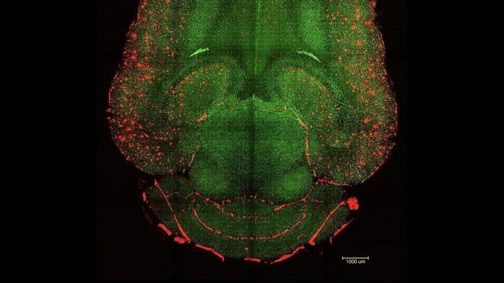 aab5fc73 f3e5 41db 8094 63c5528915d1 16 9 discover aspect ratio default 0