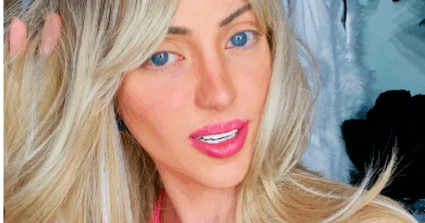 Muere Barbara Jankavski, la ‘Barbie Humana’ de Brasil