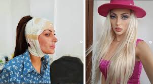 Muere Barbara Jankavski, la 'Barbie Humana' de Brasil 2 barbie humana 1