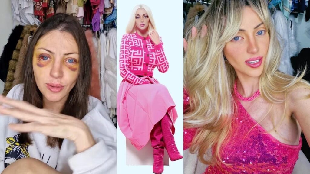 Muere Barbara Jankavski, la 'Barbie Humana' de Brasil 3 barbie humana2