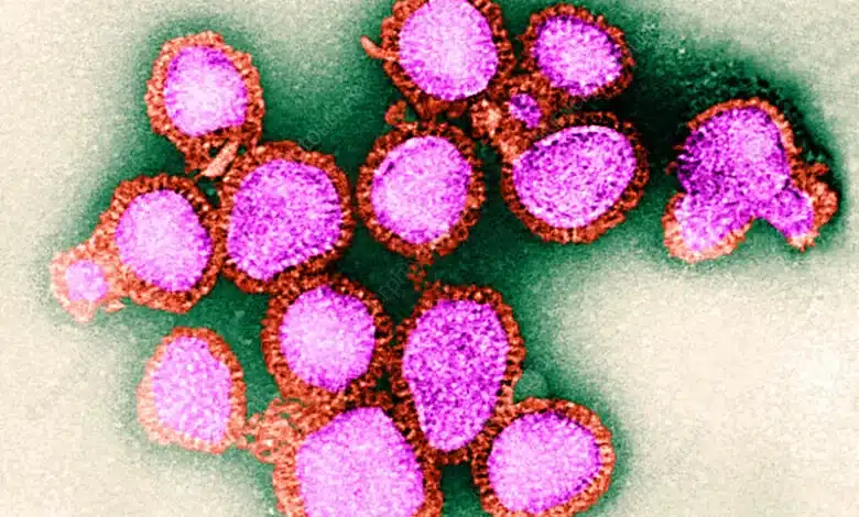 AICM Refuerza vigilancia sanitaria por circulación de influenza A(H3N2) 2 AICM 3