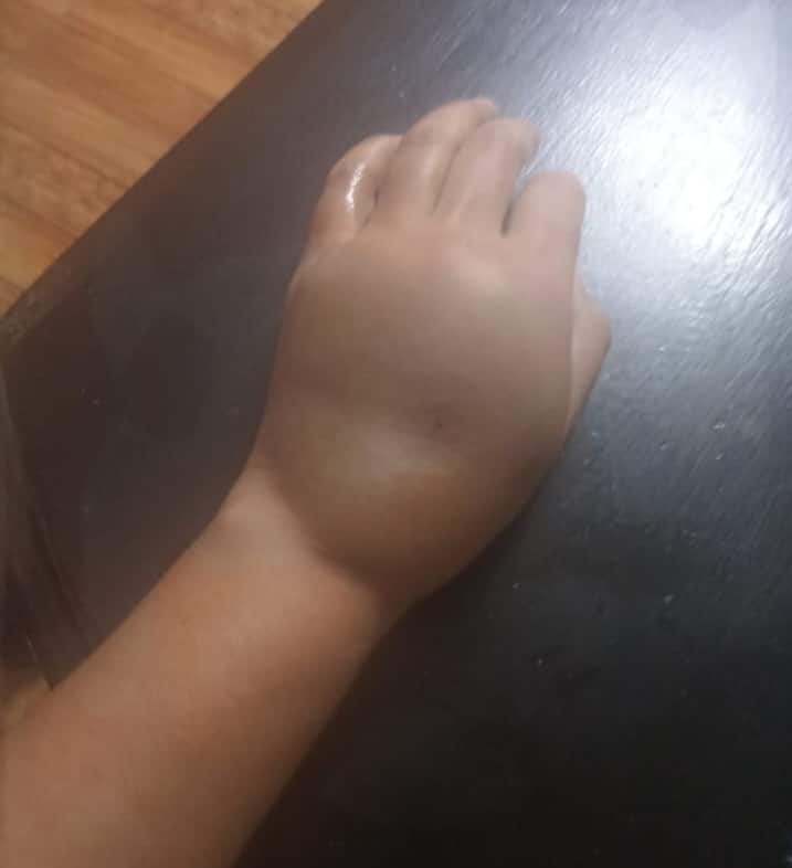 Denuncian a Cruz Roja en Coesprisson