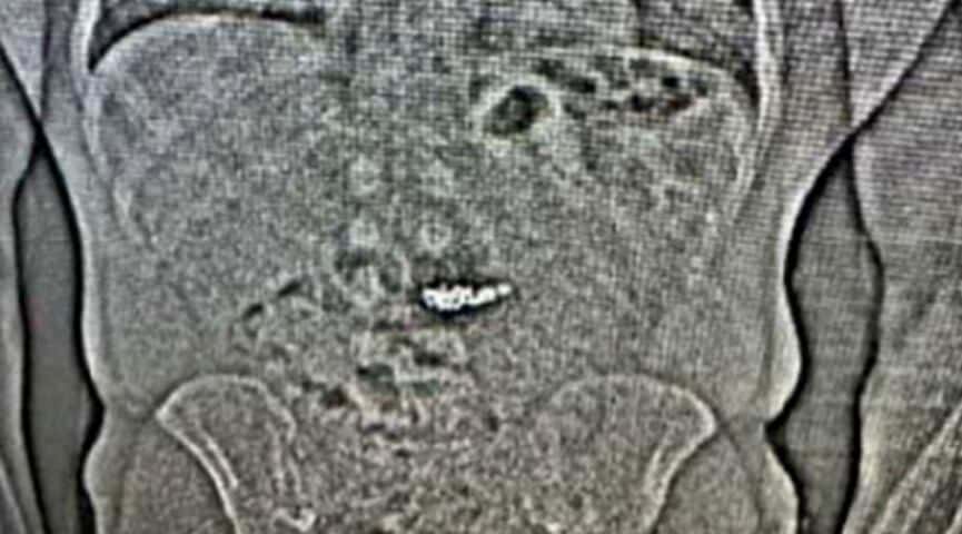 Ladrón se traga collar de oro y diamantes en Nueva Zelanda