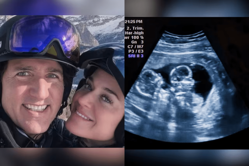 Especulación sobre el posible embarazo de Katy Perry y Trudeau 1 Especulación