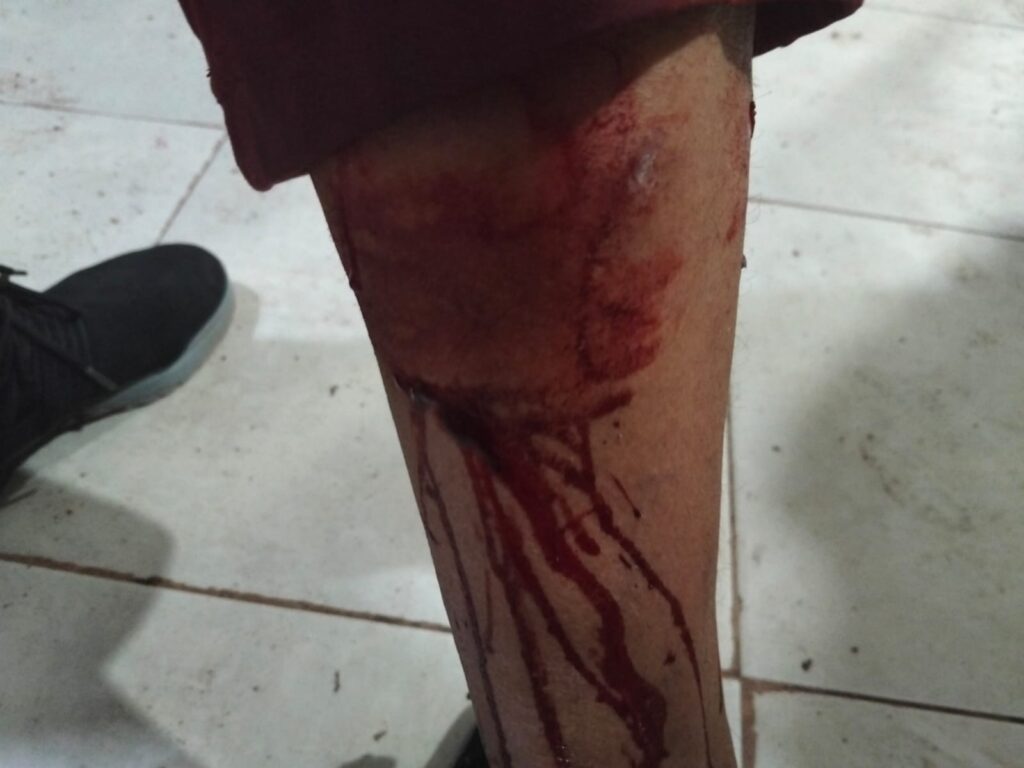 Pitbull ataca a mujer 2 IMG 20260323 WA0060 1