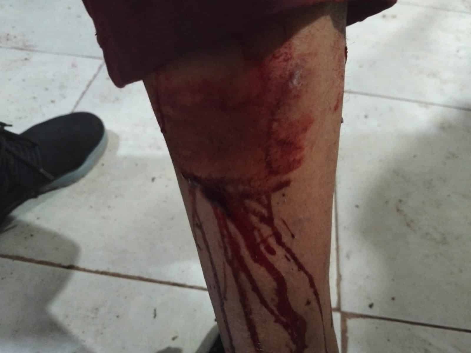 Pitbull ataca a mujer