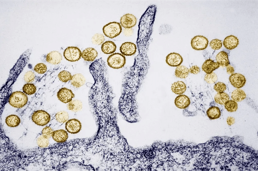 Primer análisis genético del hantavirus en el crucero confirma la variante Andes
