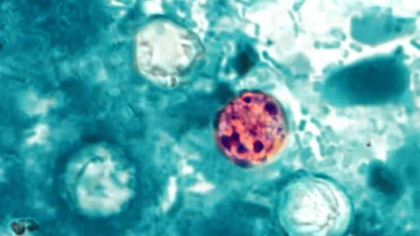 Aumentan casos de ciclosporiasis en Estados Unidos 1 image
