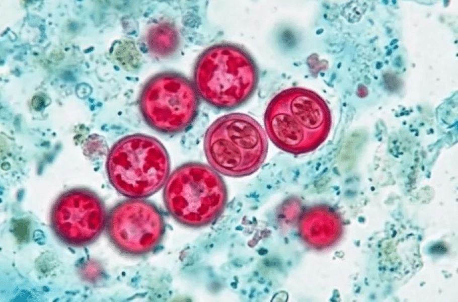 Salud confirma 33 casos de ciclosporiasis en México 1 image