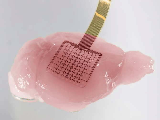 El grafeno permite estudiar la vulnerabilidad de las neuronas tras un ictus 1 image